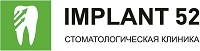 Имплант 52
